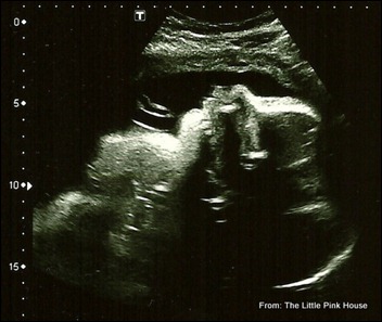 Here's the little one's profile in the ultrasound today, in which the very active child measured even further along.